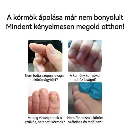 VeraNooks OrthoClip™ – professzionális körömvágó olló, ideális idősek, cukorbetegek, hátfájással vagy ízületi gyulladással küzdők számára.